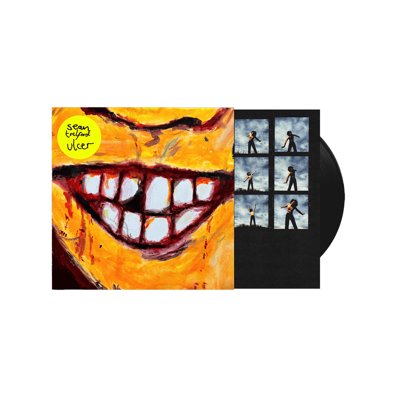Ulcer Standard LP